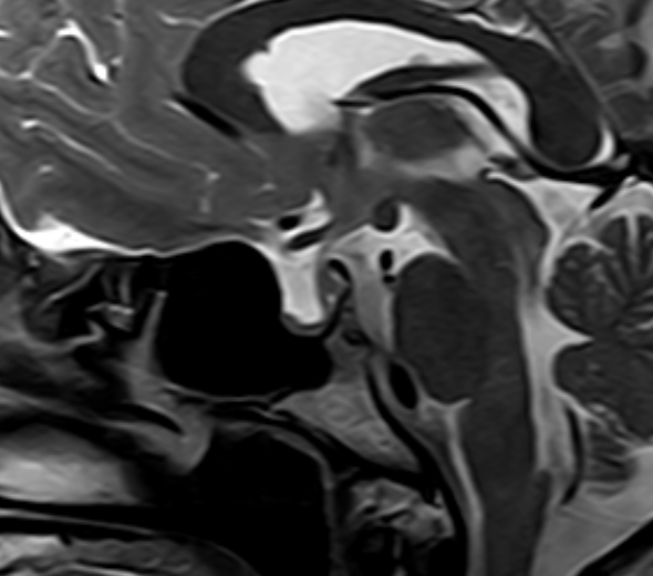 1524110338824916.jpg 1524110338824916.jpg