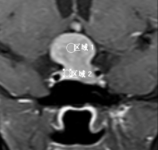 1524110339980396.jpg 1524110339980396.jpg